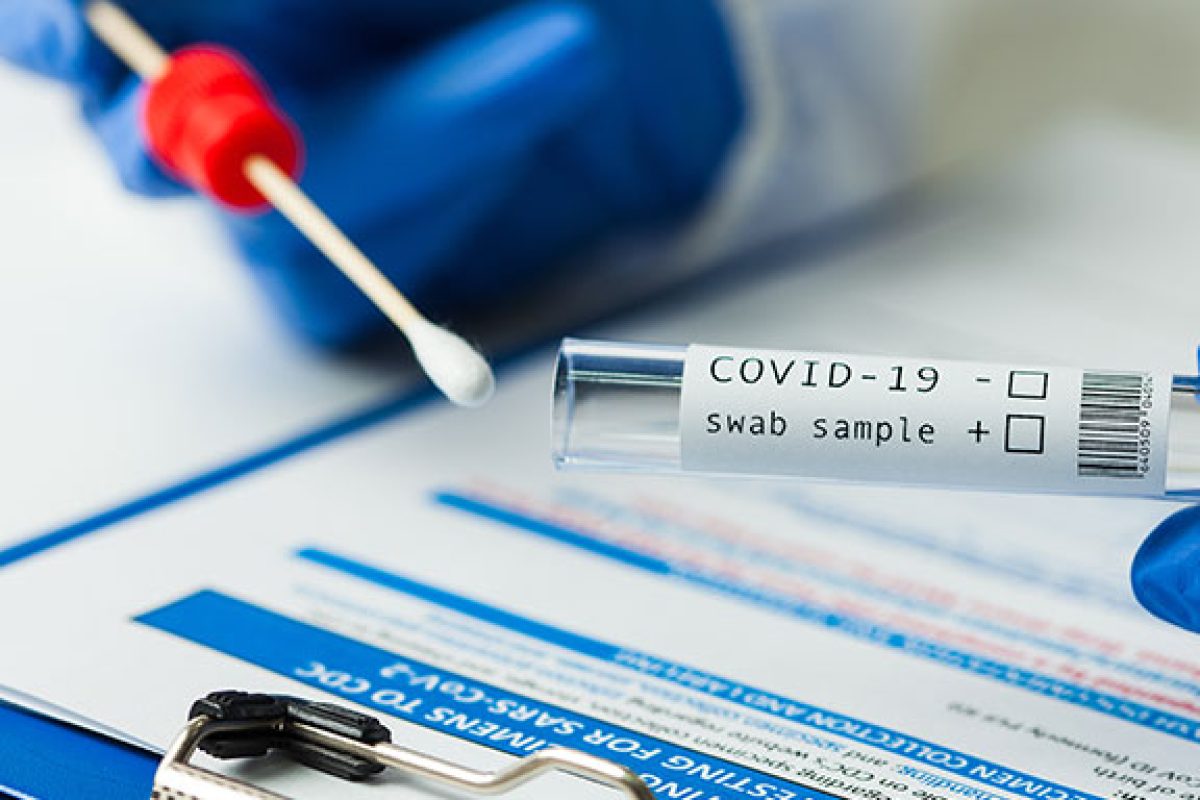 news-artexe-tampone-covid