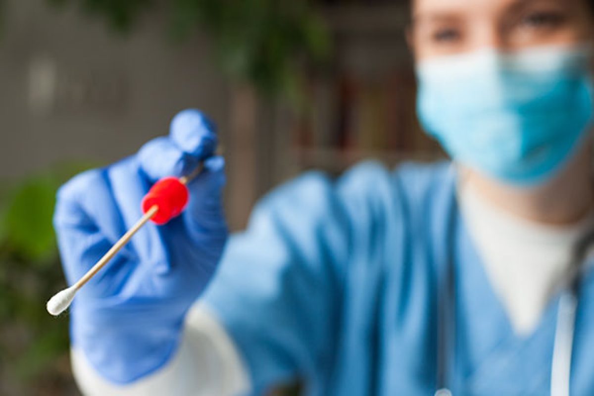 tamponi-zerocoda-artexe